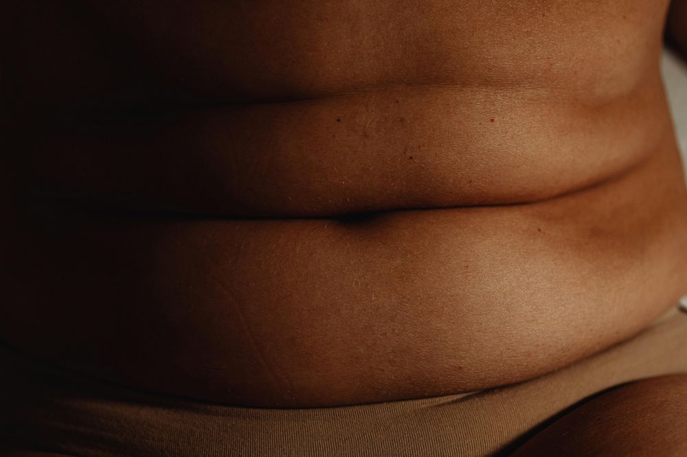 Fettsugning av magen: en djup inblick